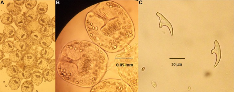 The first report of two cases of cystic echinococcosis in the lung by <i>Echinococcus ortleppi</i> infection, in Vietnam.