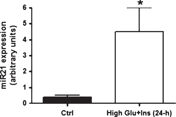 MicroRNA 21 is up-regulated in adipose tissue of obese diabetic subjects.