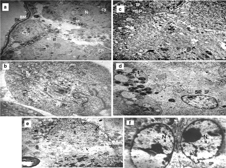 Protective role of hesperidin against γ-radiation-induced oxidative stress and apoptosis in rat testis.