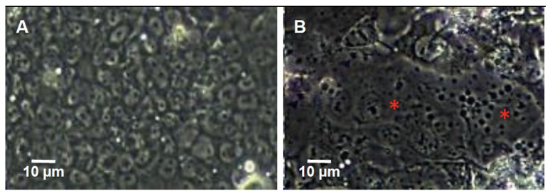 Optimization of BeWo model to investigate placental responses to <i>Plasmodium falciparum</i> infected erythrocytes.