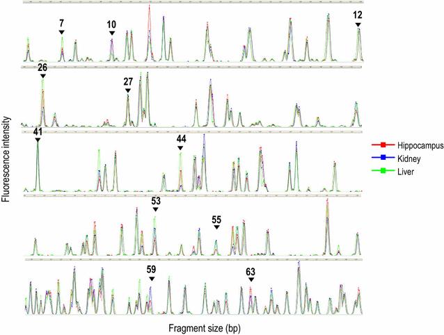 Methylated site display (MSD)-AFLP, a sensitive and affordable method for analysis of CpG methylation profiles