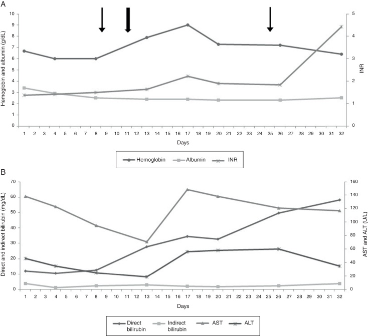 Sickle cell intrahepatic cholestasis unresponsive to exchange blood transfusion: a case report