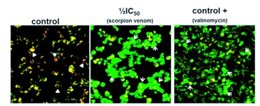 <i>Rhopalurus junceus</i> scorpion venom induces apoptosis in the triple negative human breast cancer cell line MDA-MB-231.