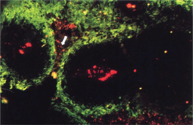 A review of the development of tumor vasculature and its effects on the tumor microenvironment.