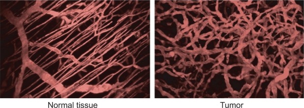 A review of the development of tumor vasculature and its effects on the tumor microenvironment.