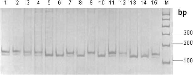 Two single nucleotide polymorphisms sites in <i>α1</i>-<i>AT</i> gene and their association with somatic cell score in Chinese Holstein cows.