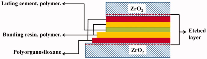 A novel etching technique for surface treatment of zirconia ceramics to improve adhesion of resin-based luting cements.