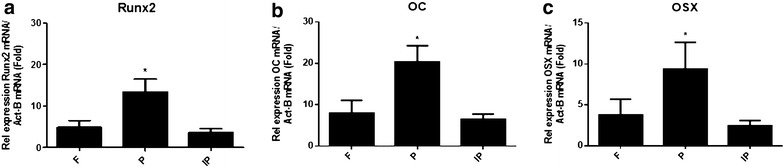 Bone marker gene expression in calvarial bones: different bone microenvironments.