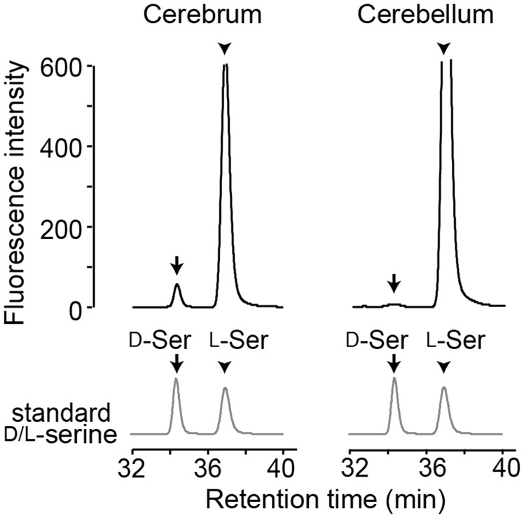 Heterogeneity of D-Serine Distribution in the Human Central Nervous System.