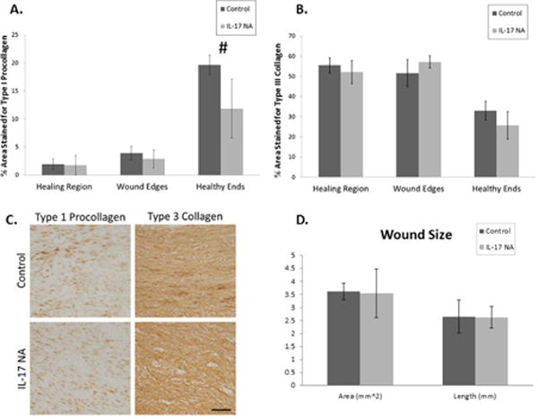 Impacts of Interleukin-17 Neutralization on the Inflammatory Response in a Healing Ligament.