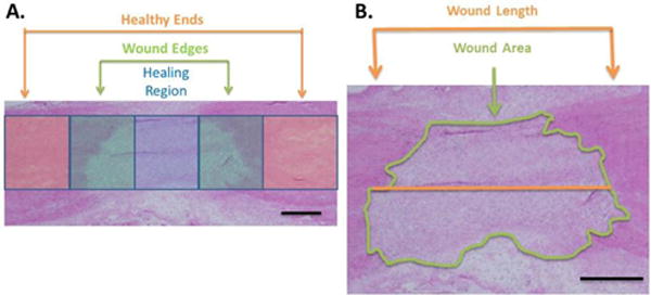 Impacts of Interleukin-17 Neutralization on the Inflammatory Response in a Healing Ligament.