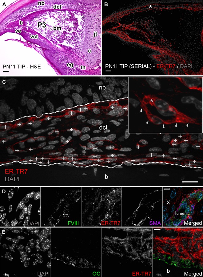 Fibroblast reticular cells engineer a blastema extracellular network during digit tip regeneration in mice.