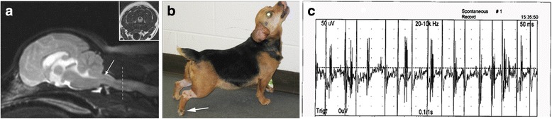 A case of stiff dog syndrome associated with anti-glutamic acid decarboxylase antibodies.