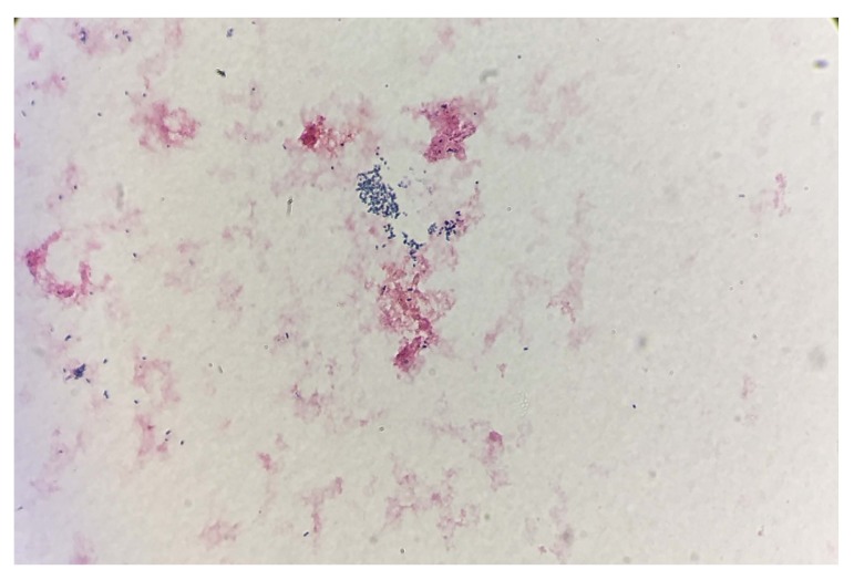 Misinterpretation of Gram Stain from the Stationary Growth Phase of Positive Blood Cultures for <i>Brucella</i> and <i>Acinetobacter</i> Species.