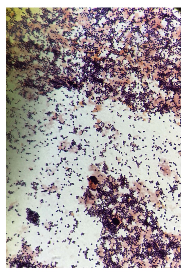 Misinterpretation of Gram Stain from the Stationary Growth Phase of Positive Blood Cultures for <i>Brucella</i> and <i>Acinetobacter</i> Species.