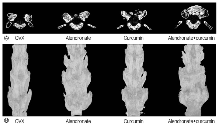 The Therapeutic Effects of Combination Therapy with Curcumin and Alendronate on Spine Fusion Surgery in the Ovariectomized Rats.