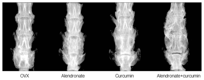 The Therapeutic Effects of Combination Therapy with Curcumin and Alendronate on Spine Fusion Surgery in the Ovariectomized Rats.