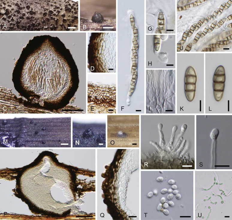 Pseudodidymellaceae fam. nov.: Phylogenetic affiliations of mycopappus-like genera in Dothideomycetes