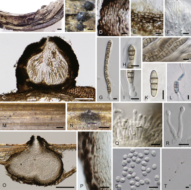 Pseudodidymellaceae fam. nov.: Phylogenetic affiliations of mycopappus-like genera in Dothideomycetes