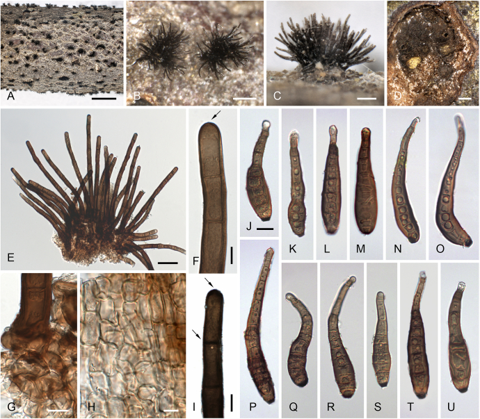 Corynespora, Exosporium and Helminthosporium revisited – New species and generic reclassification