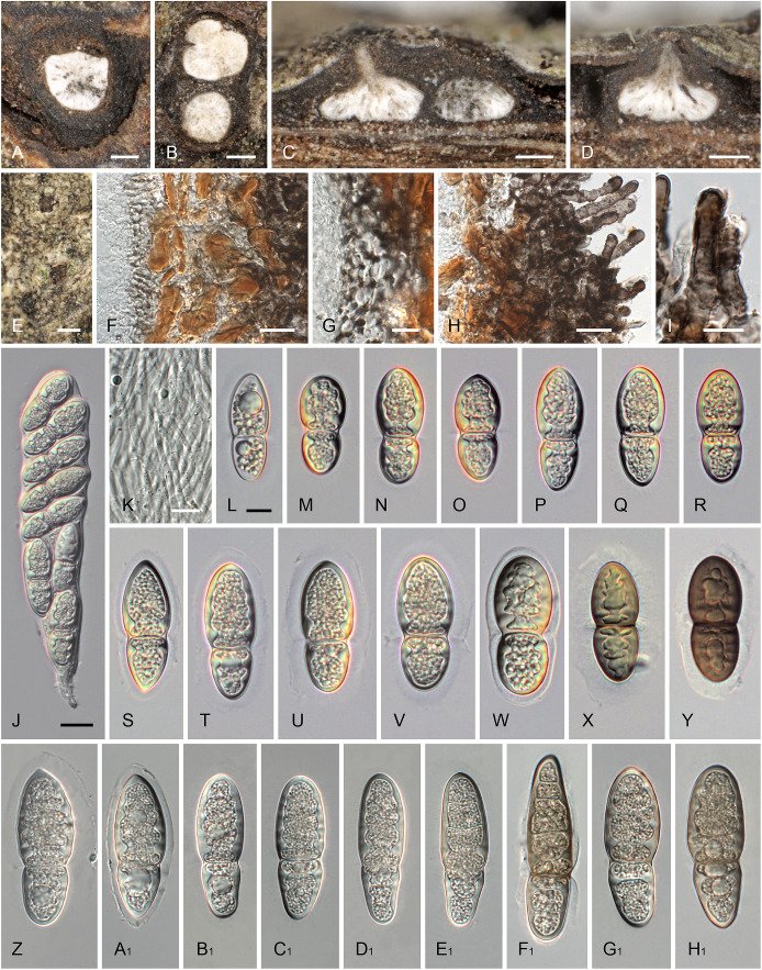 Corynespora, Exosporium and Helminthosporium revisited – New species and generic reclassification