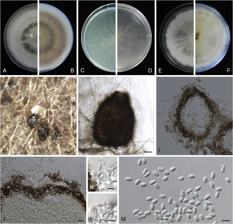 Didymellaceae revisited