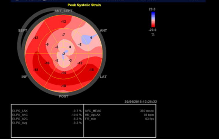 Role of 2D speckle tracking echocardiography in predicting acute coronary occlusion in patients with non ST-segment elevation myocardial infarction