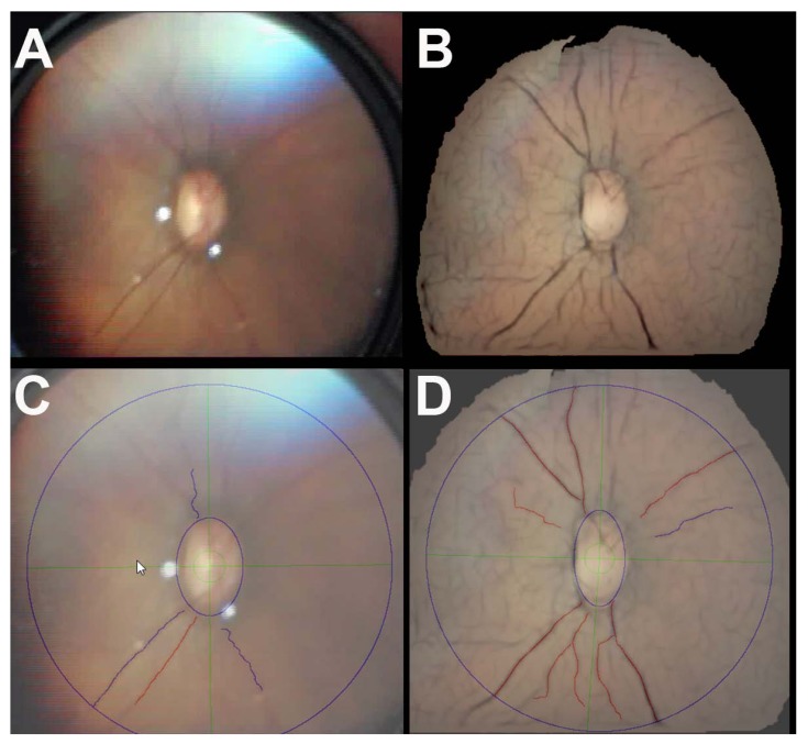 Using an Image Fusion Methodology to Improve Efficiency and Traceability of Posterior Pole Vessel Analysis by ROPtool.