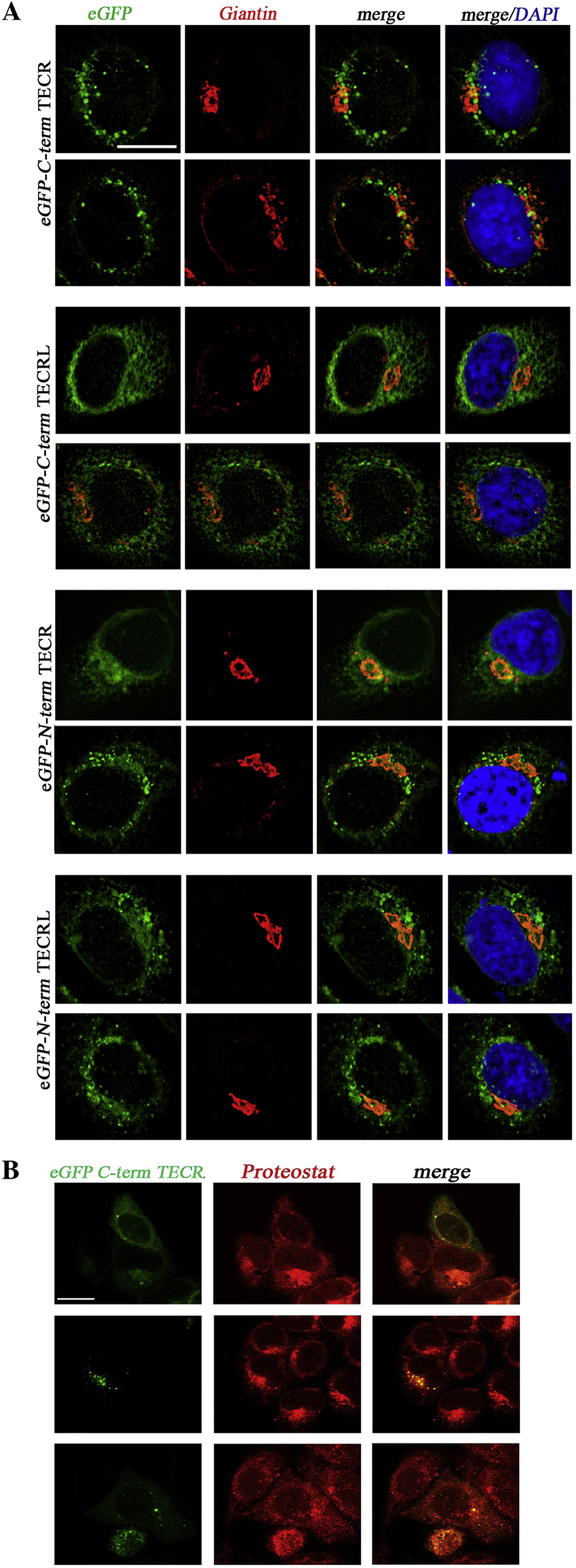 Subcellular localization of the five members of the human steroid 5α-reductase family