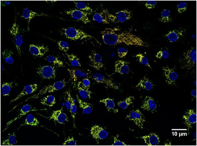 Cumulus cell mitochondrial activity in relation to body mass index in women undergoing assisted reproductive therapy