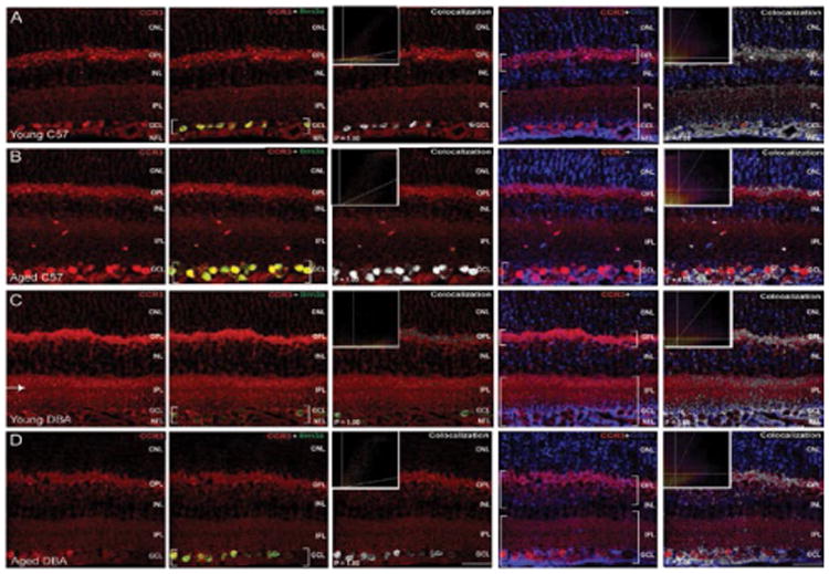 Constitutive and Stress-induced Expression of CCL5 Machinery in Rodent Retina.