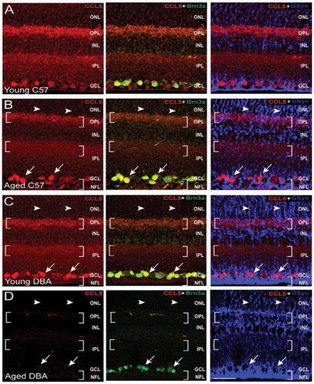 Constitutive and Stress-induced Expression of CCL5 Machinery in Rodent Retina.