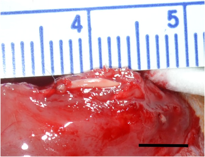 Tissue-Engineered Tendon for Enthesis Regeneration in a Rat Rotator Cuff Model.