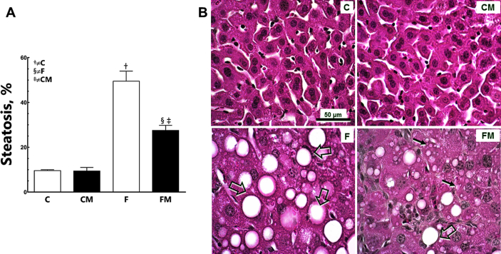 Liver and Metformin: Lessons of a fructose diet in mice