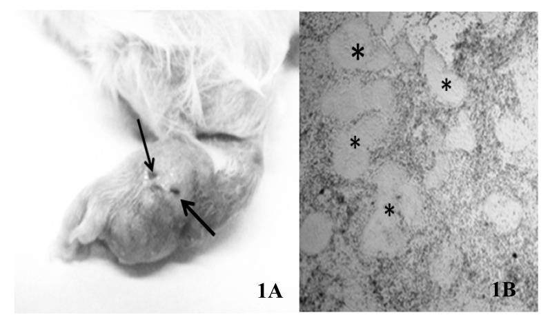 Non-Coding RNAs are Differentially Expressed by <i>Nocardia brasiliensis in Vitro</i> and in Experimental Actinomycetoma.