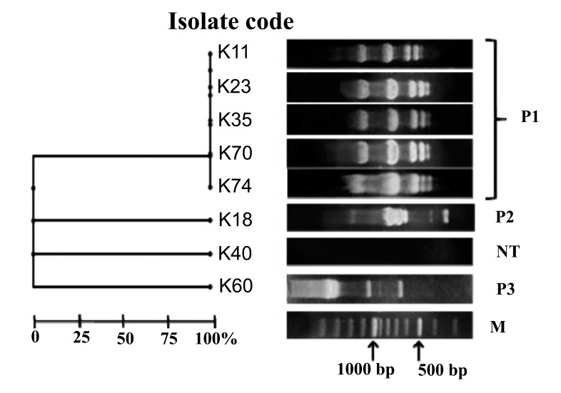 Molecular Characterization of <i>Klebsiella pneumoniae</i> Clinical Isolates with Elevated Resistance to Carbapenems.