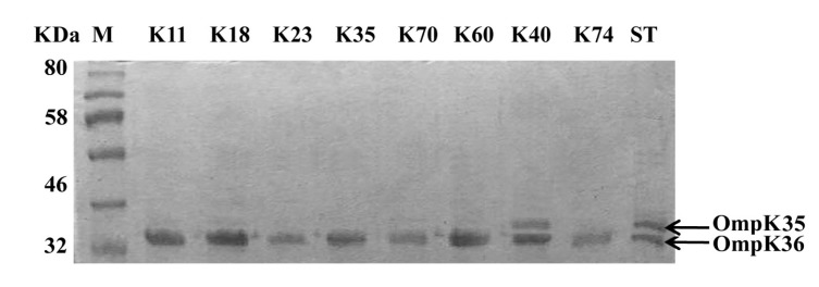 Molecular Characterization of <i>Klebsiella pneumoniae</i> Clinical Isolates with Elevated Resistance to Carbapenems.