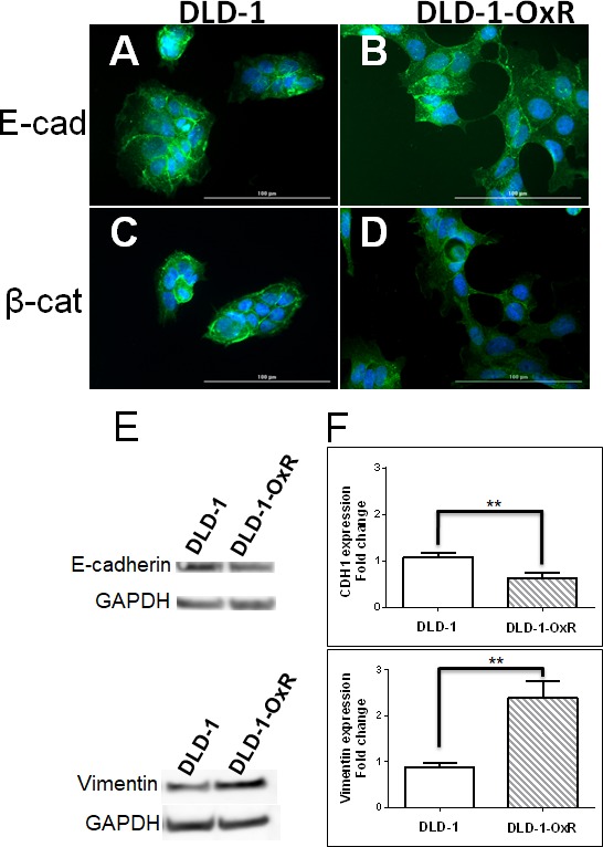 Deregulated expression of microRNA-200b/c and SUZ12, a Polycomb repressive complex 2 subunit, in chemoresistant colorectal cancer cells.