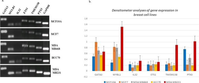 Identification of candidate genes associated with triple negative breast cancer.