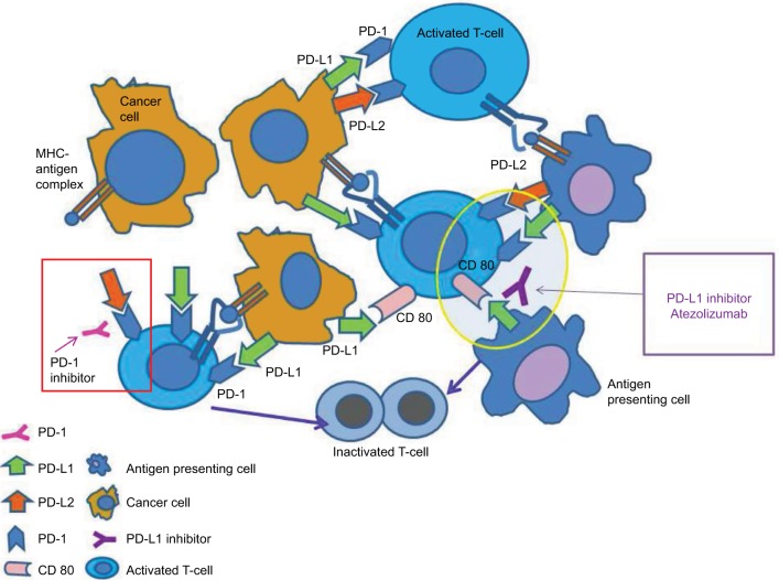 New PD-L1 inhibitors in non-small cell lung cancer - impact of atezolizumab.