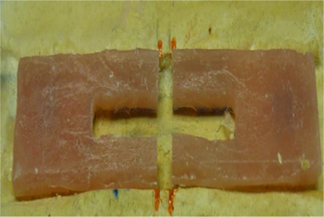 Flexural Strength of Polymethyl Methacrylate Repaired with Fiberglass.