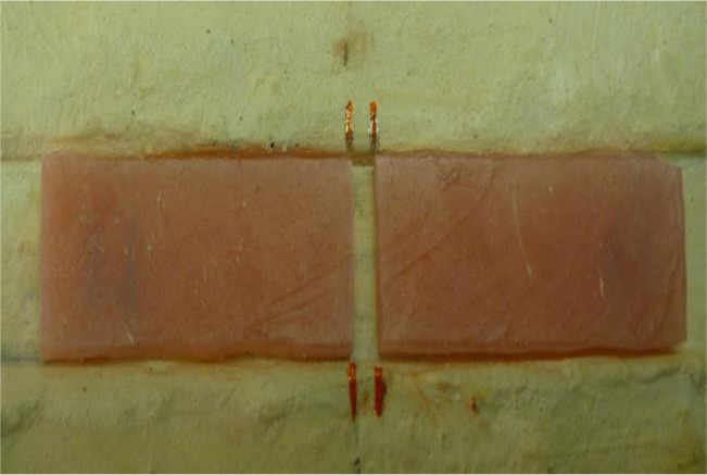 Flexural Strength of Polymethyl Methacrylate Repaired with Fiberglass.