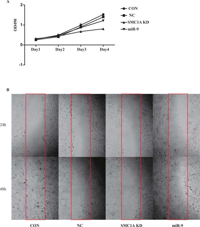 MiR-9 Promotes Apoptosis <i>Via</i> Suppressing SMC1A Expression in GBM Cell Lines.