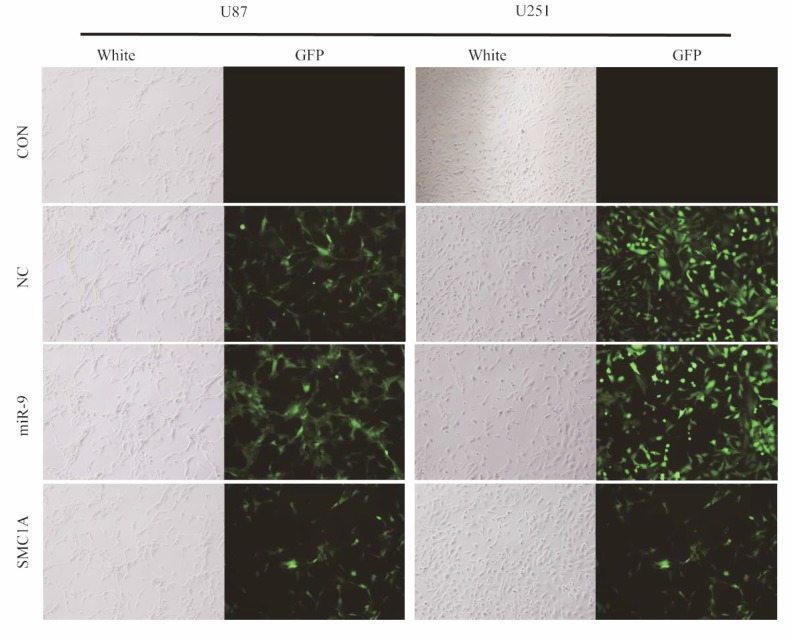 MiR-9 Promotes Apoptosis <i>Via</i> Suppressing SMC1A Expression in GBM Cell Lines.