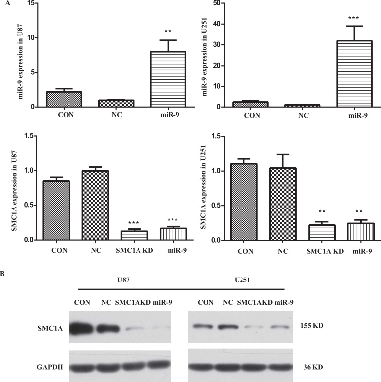 MiR-9 Promotes Apoptosis <i>Via</i> Suppressing SMC1A Expression in GBM Cell Lines.