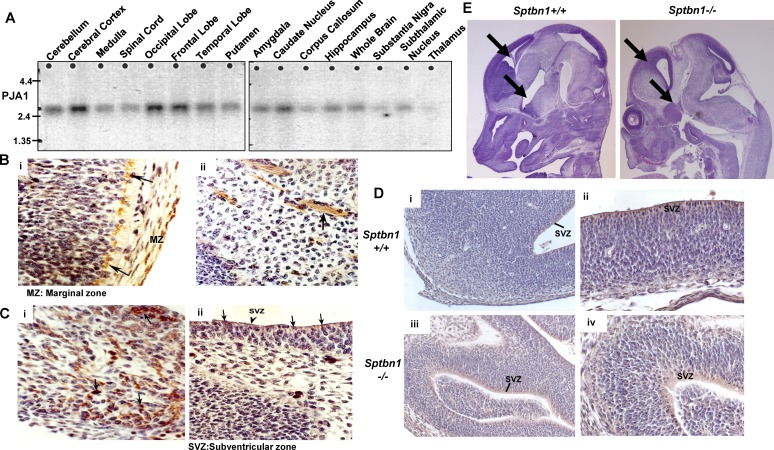 PRAJA is overexpressed in glioblastoma and contributes to neural precursor development.