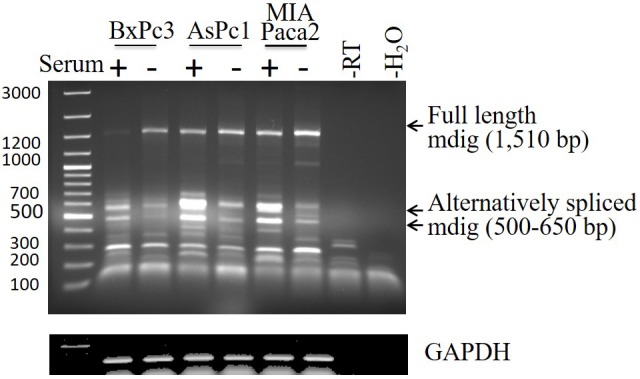 Pathological and prognostic role of mdig in pancreatic cancer.