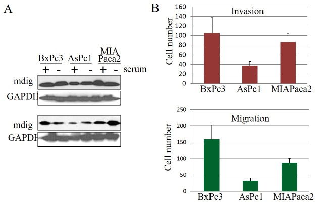 Pathological and prognostic role of mdig in pancreatic cancer.