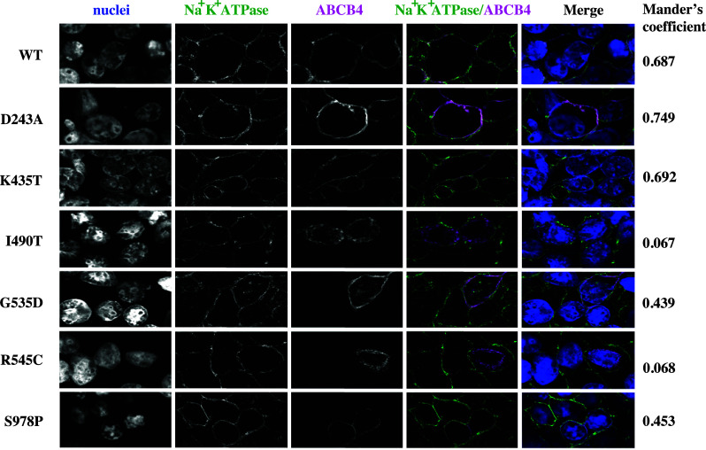 ABCB4 missense mutations D243A, K435T, G535D, I490T, R545C, and S978P significantly impair the lipid floppase and likely predispose to secondary pathologies in the human population.