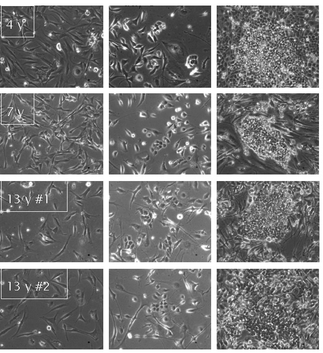 Overcoming barriers to reprogramming and differentiation in nonhuman primate induced pluripotent stem cells.